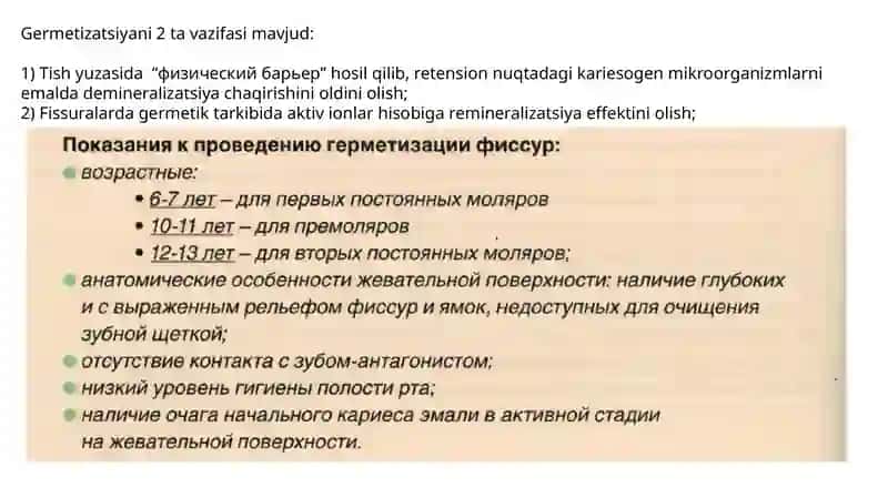 Fissuralar germetizatsiyasi 3