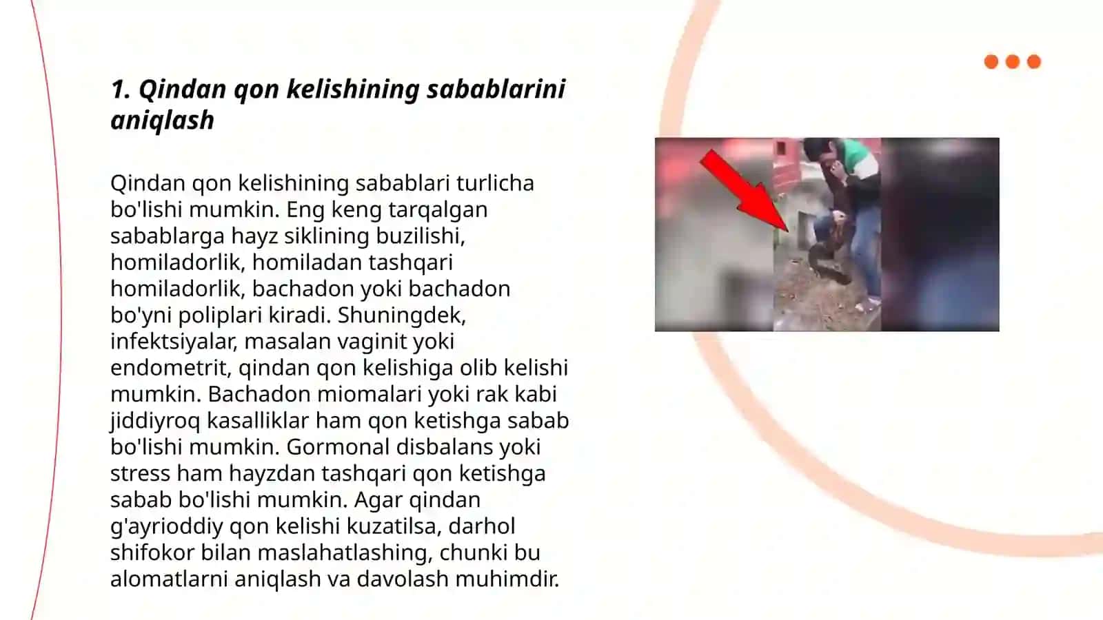 Qindan qon kelganda birinchi yordam ko‘rsatish Rustamova Asilaxon 3