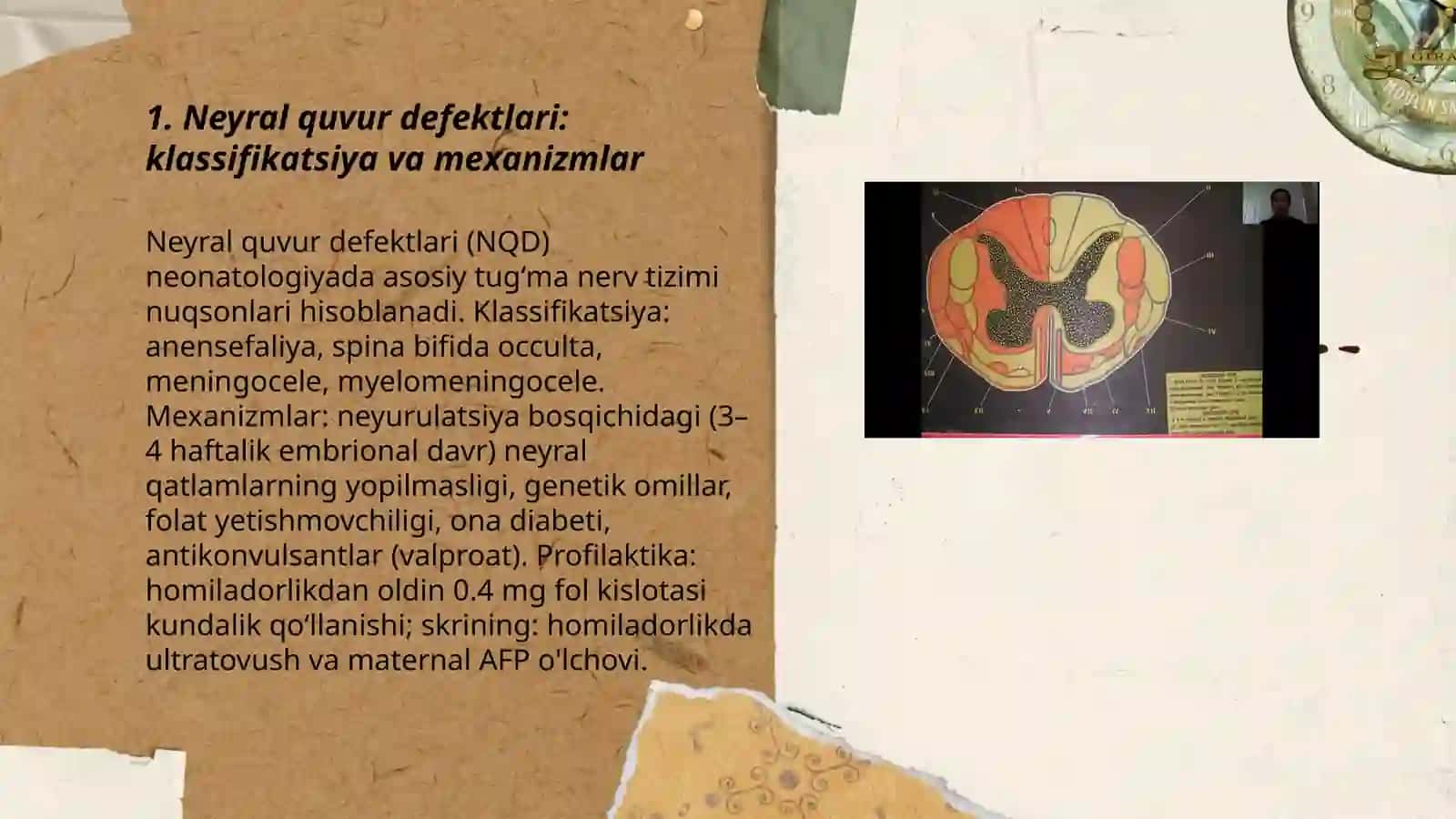 Bolalarda Bosh va boʻyin tugʻma rivojlanish nuqsonlari 3