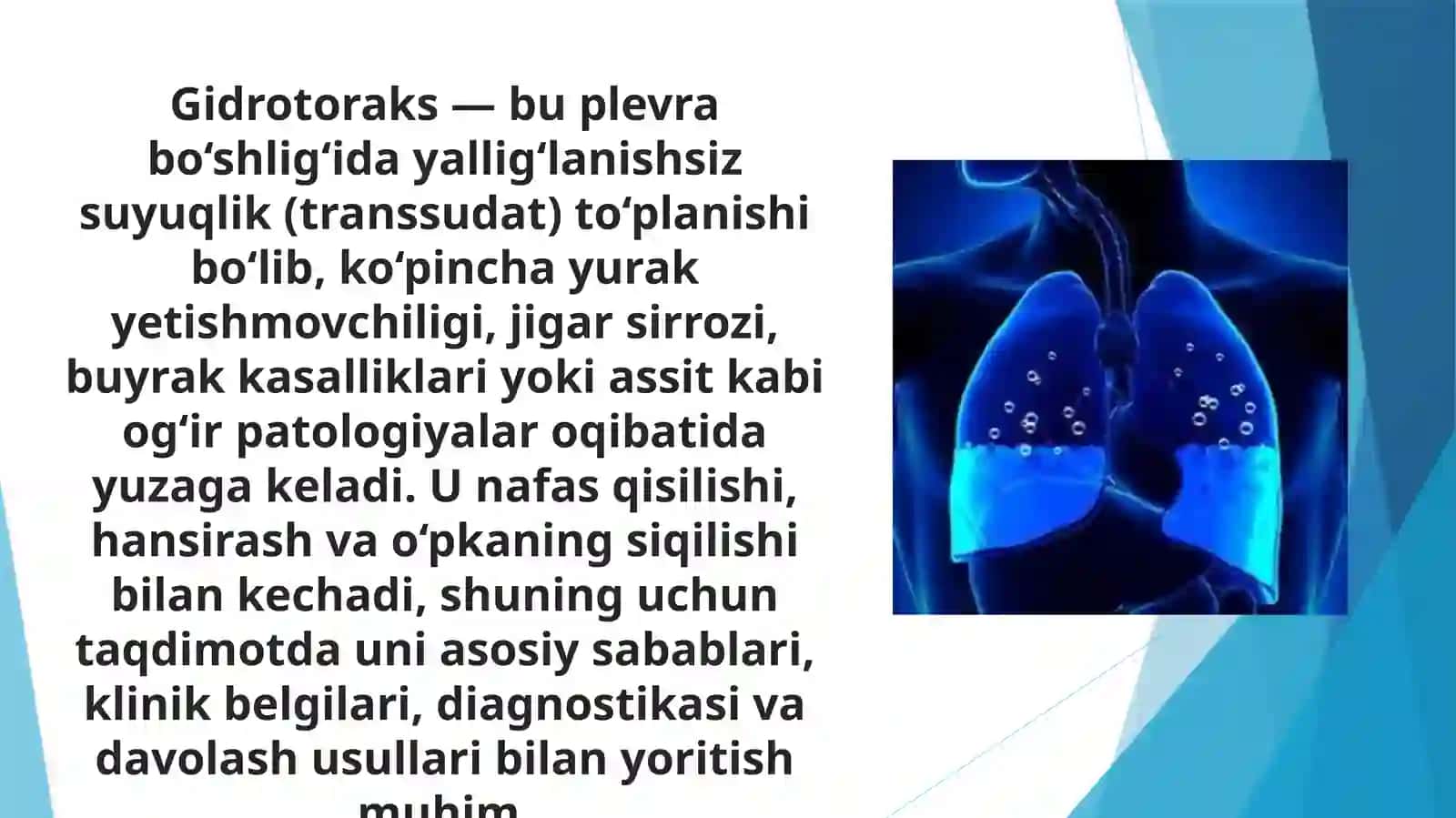 Gidrotoraks 3