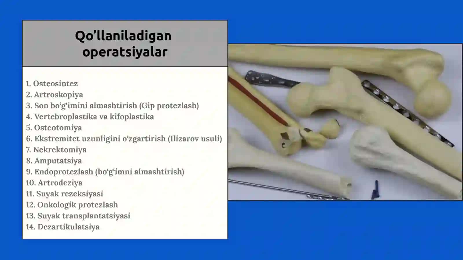 Suyaklar patologiyalari. Endoprotezlash. Osteoparoz. Osteoartrit 3