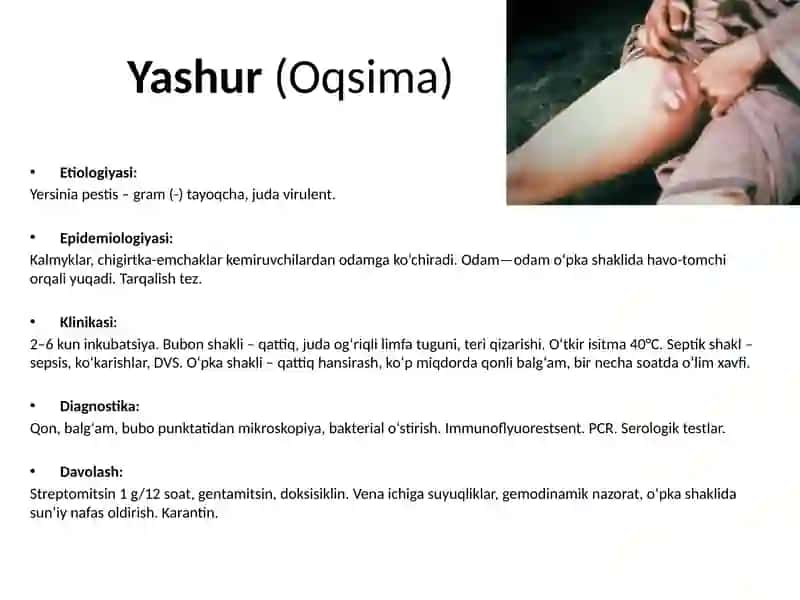 Tulyaremiya 3