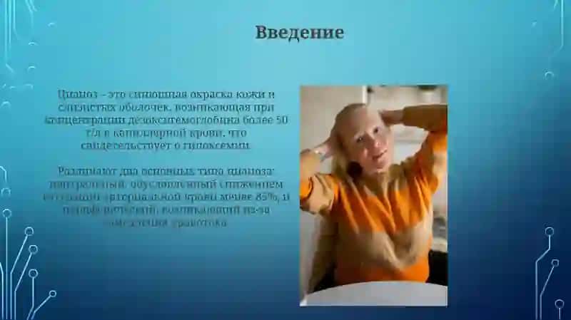 Синдромцианоза 3
