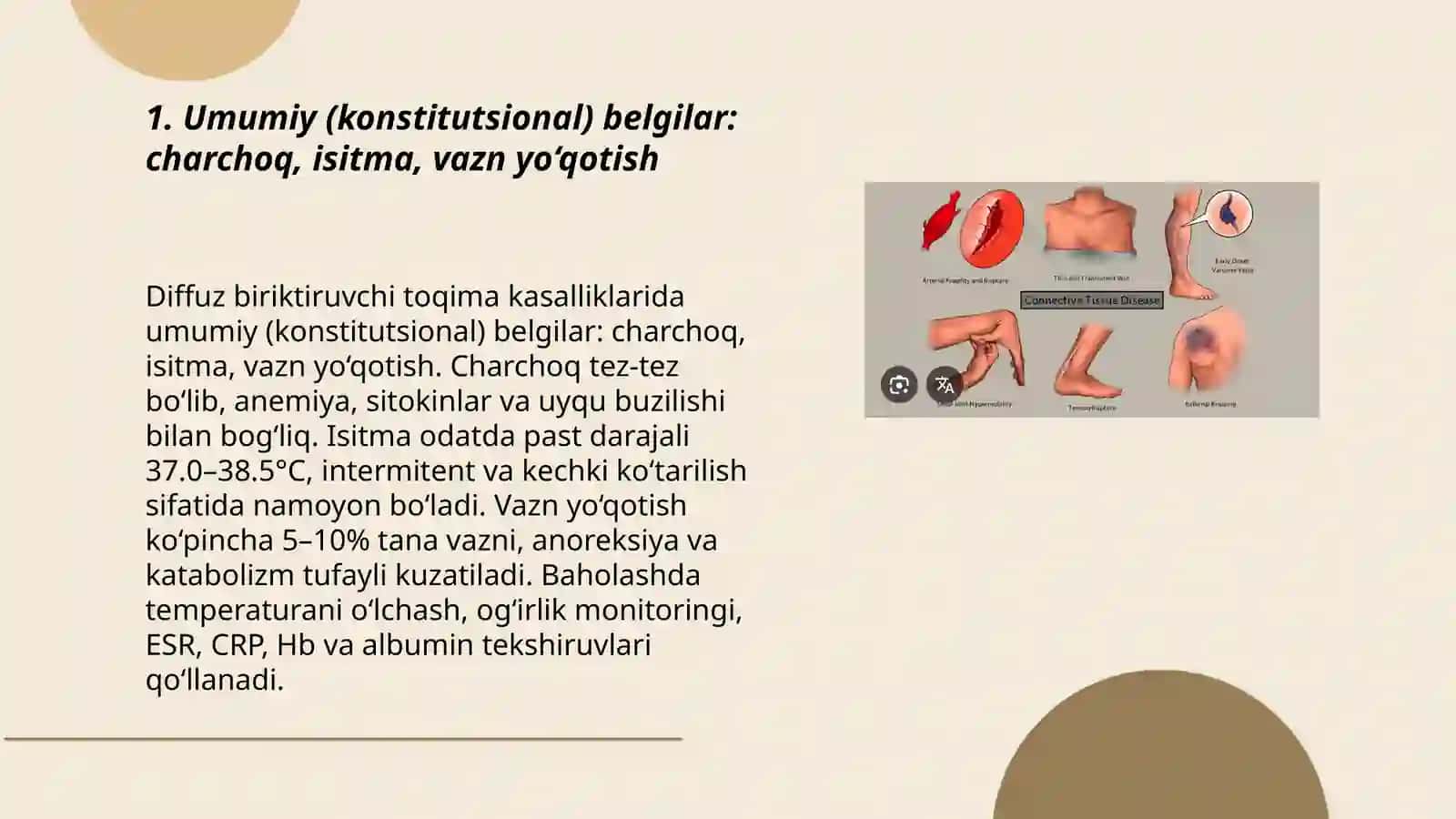 Biriktiruvchi toqima diffuz kasalliklarida umumiy belgilar va sindromlar 3