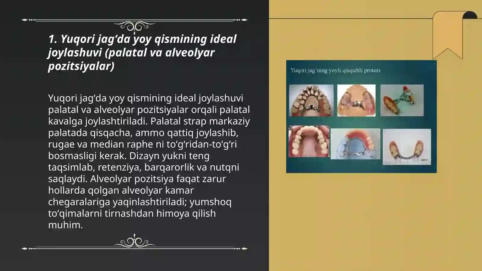 Yuqori va pastki jagʻda yoyli protezlarning yoy qismini joylashuvi 3