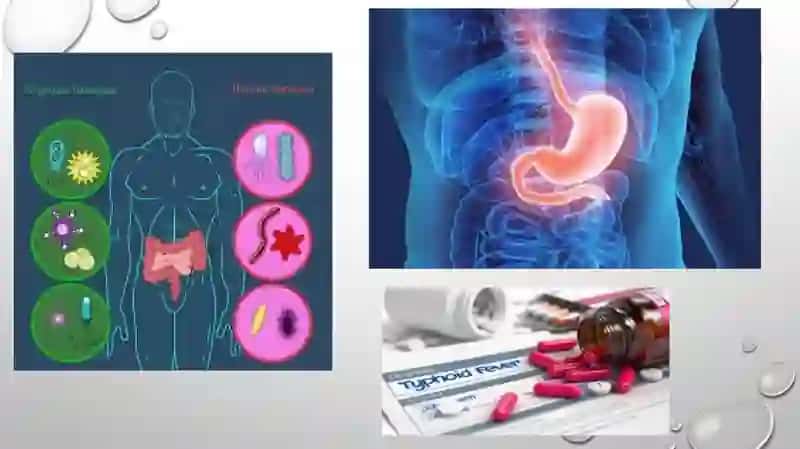 Disbakterioz va disbakteriozning zamonaviy bakteriologik diagnostikasi. 3