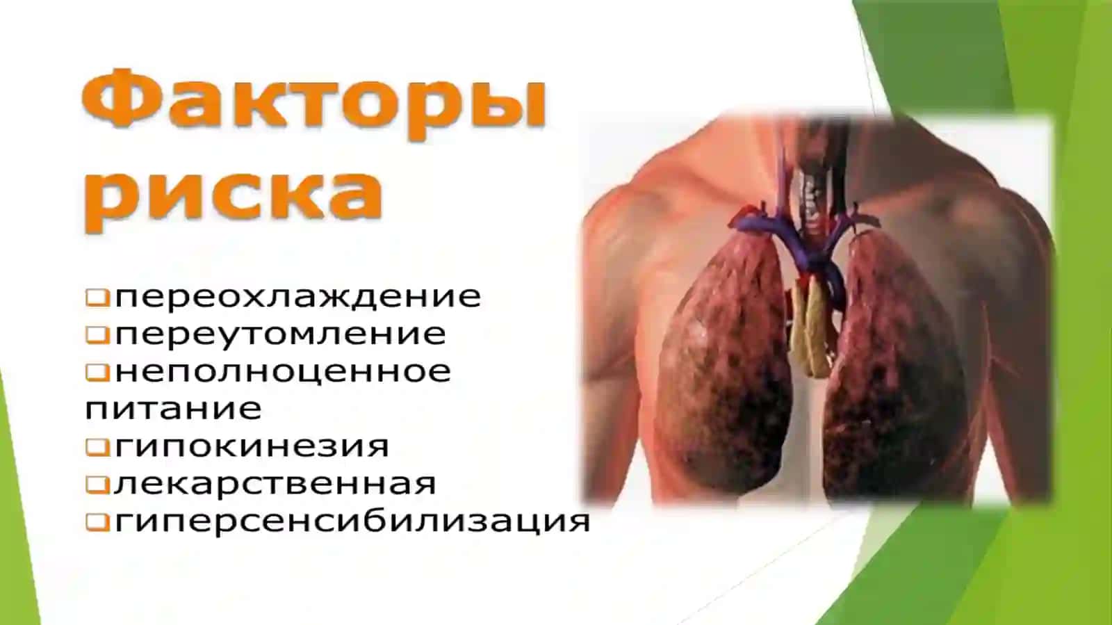 Плеврит 3