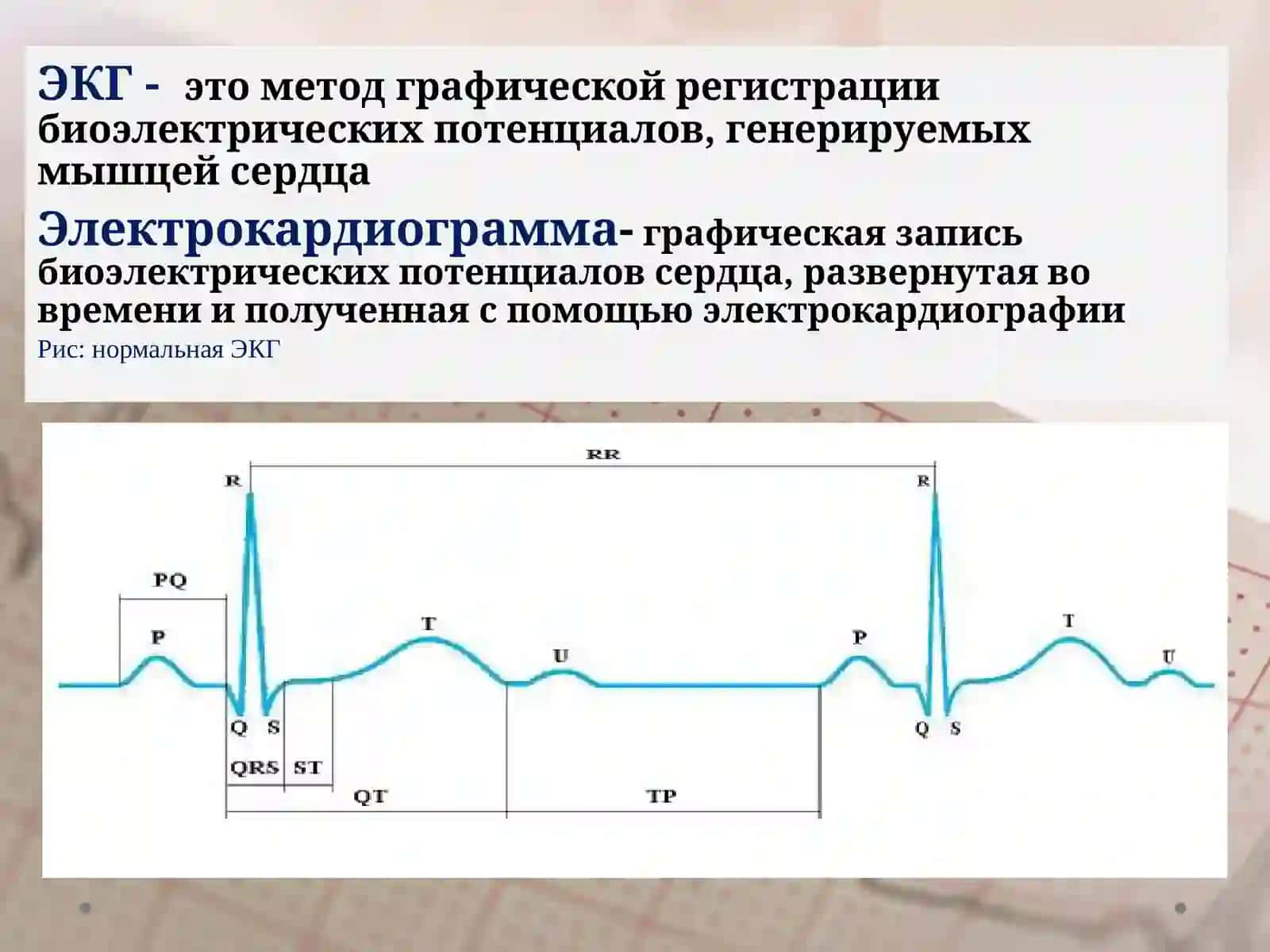 Основы ЭКГ 3