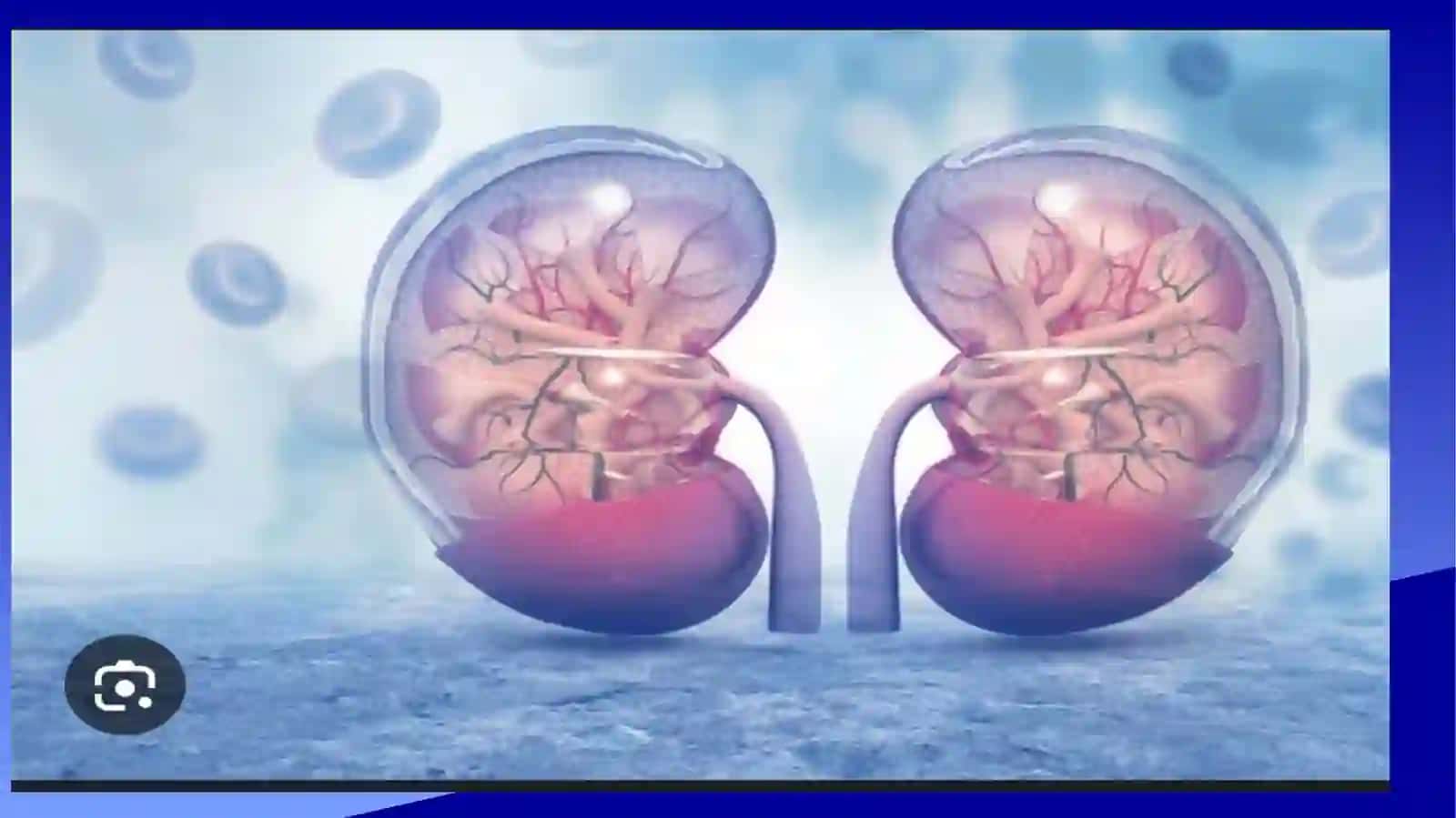Glomerulonefrit, endokardit yarali kolit va boshqa kasallilklar kelib chiqishida mikroorganizimlarni ahamyati 3