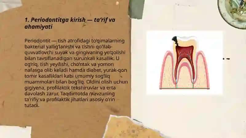 Periodontit taqdimoti 3