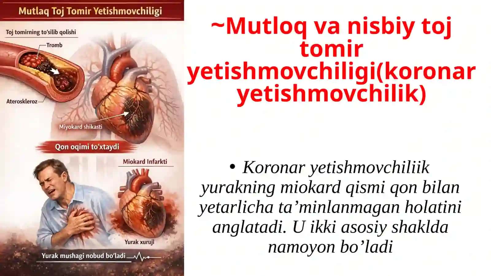 Mutloq vanisbiy tojtomir yetishmovchiligi 3