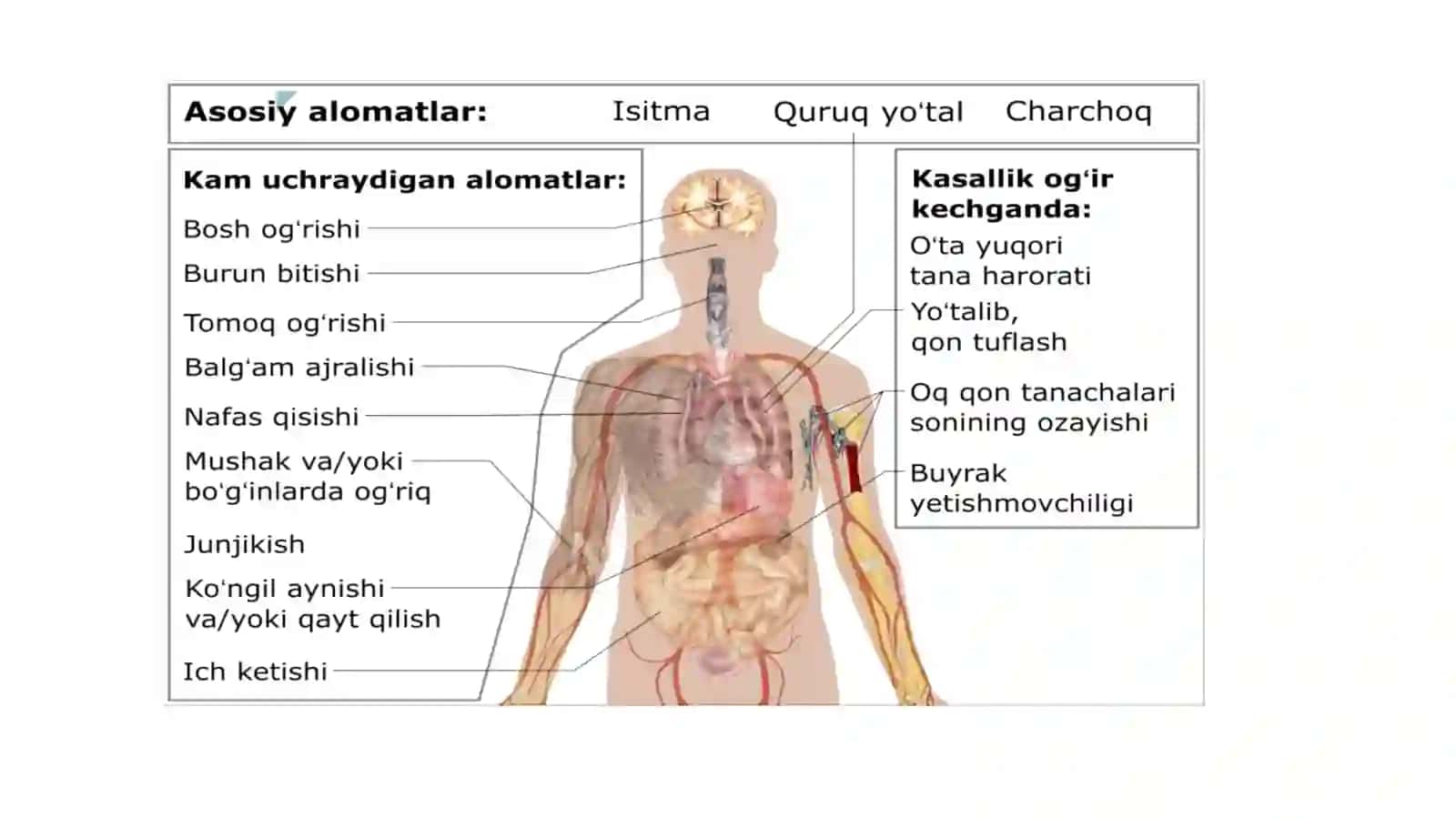Pandemiya – XXI asrning global muomosi va uning oqibatlari 3