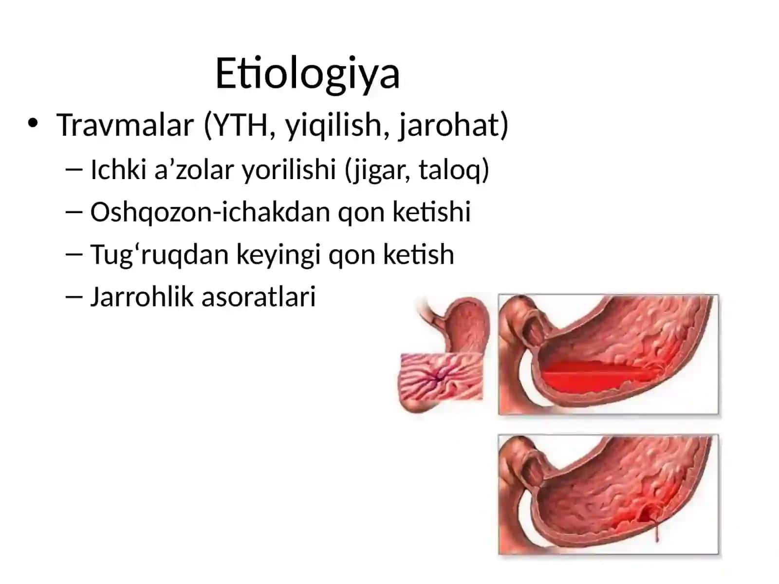 MASSIV QON KETISHIDA TEZ TIBBIY YORDAM 3