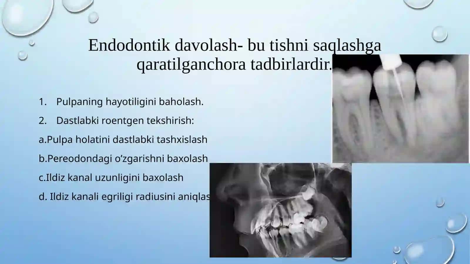 Ildiz kanal o'zini kengaytiruvchi asboblar 3