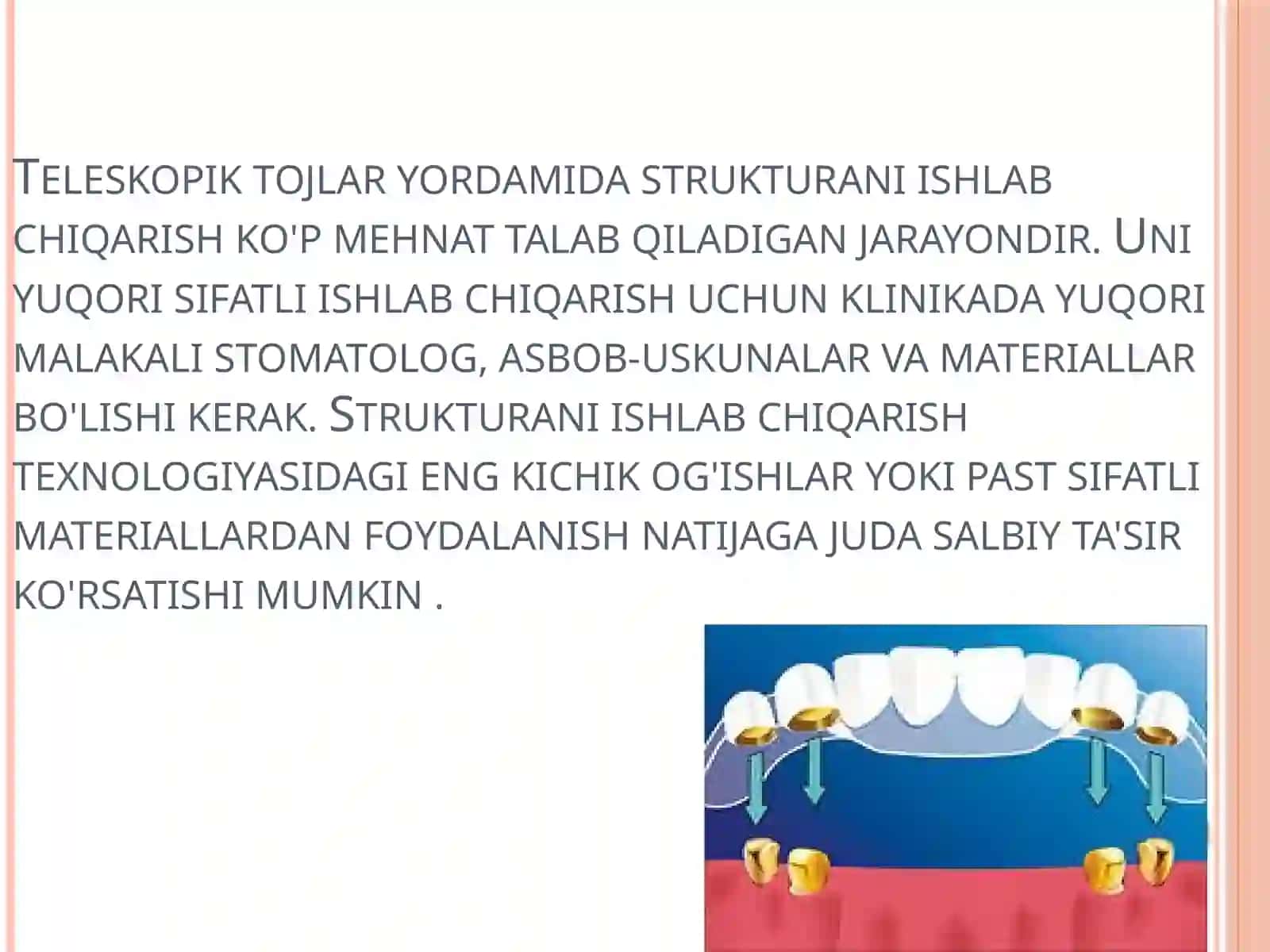Teleskopik qoplamalar fiksatsiya elementi sifatida 3