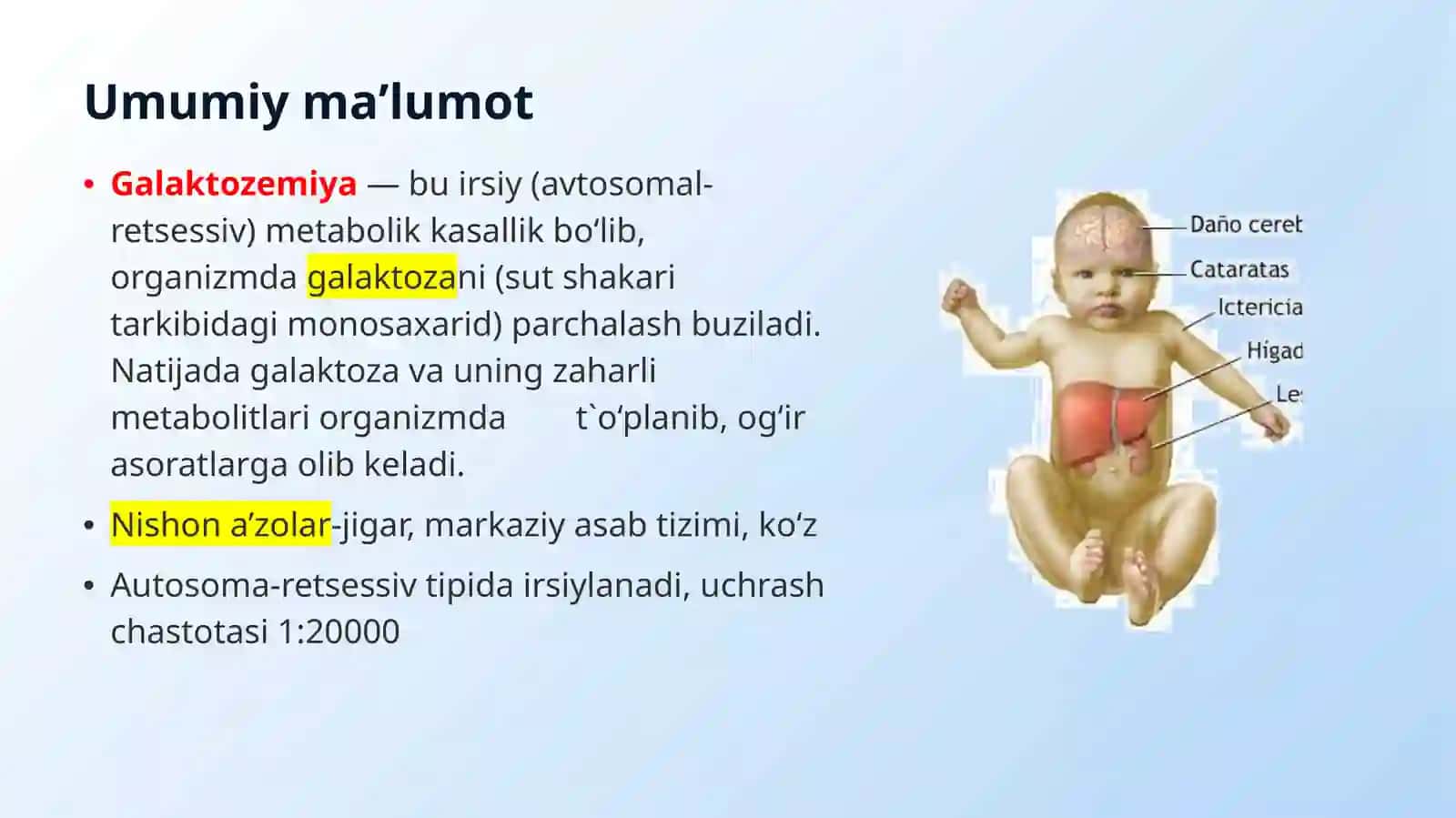 Uglevodlar almashinuvi buzilishi bilan kechuvchi kasalliklar (galaktozemiya, fruktozemiya,glikogenozlar) 3
