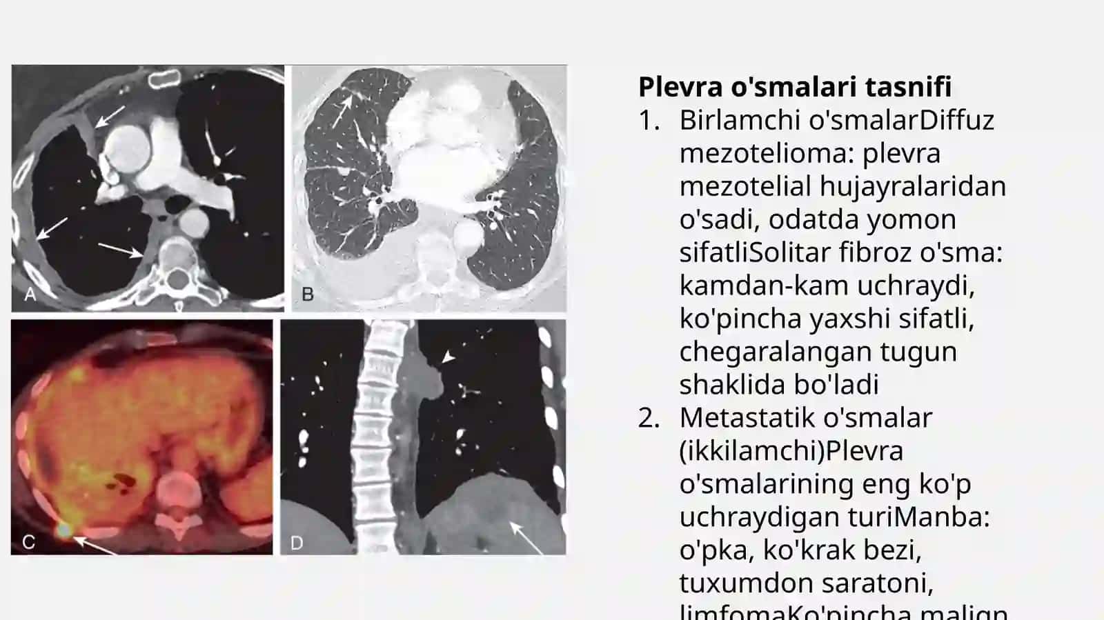 Plevra, mediastinum va yurak o‘smalari — 18 slaydli taqdimot 3