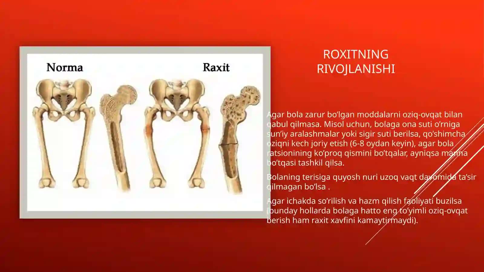 RaxitKASALLIGI 3