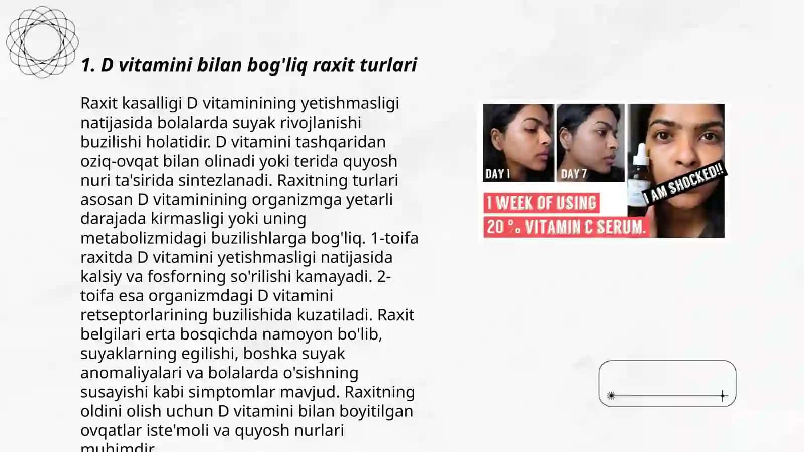D vitaminga rezistent raxit 3