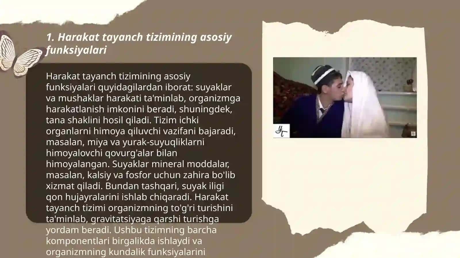 Harakat tayanch aʼzolari jarohatlangan bolalar 3