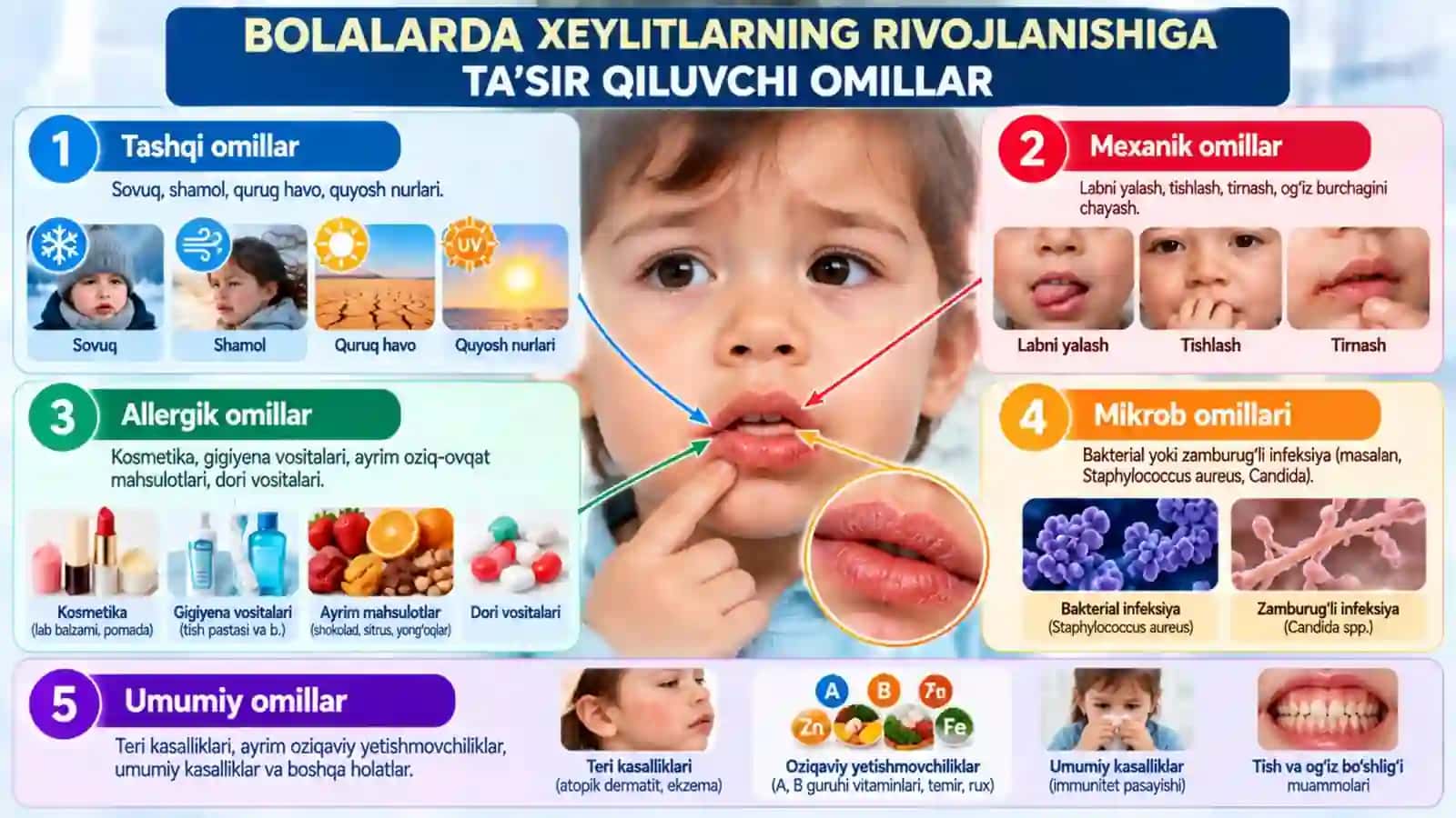 Bolalarda lab kasalliklari Atipik, Ekzematoz va Angulyar xeylitlar Klinik belgilar, tashxis, davolash va profilaktika.pptx 3