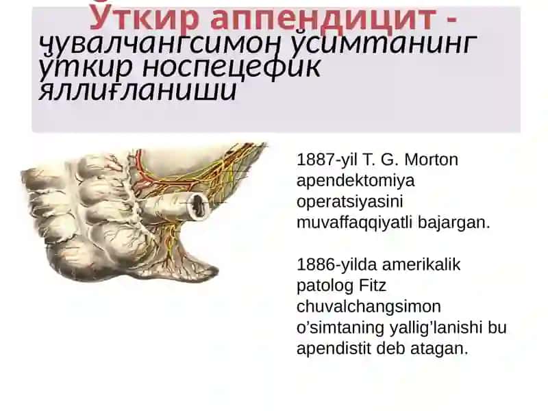 O`tkir appenditsit 3