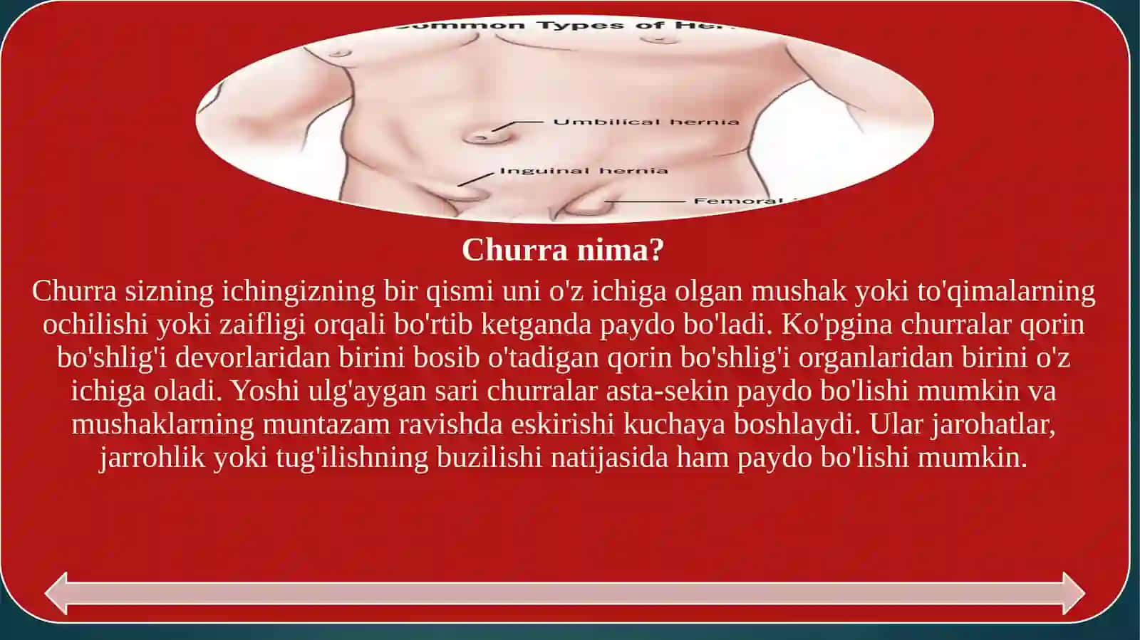 Herniya 3