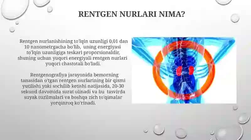Rentgen nurlar va ularni organizmga ta'siri 3