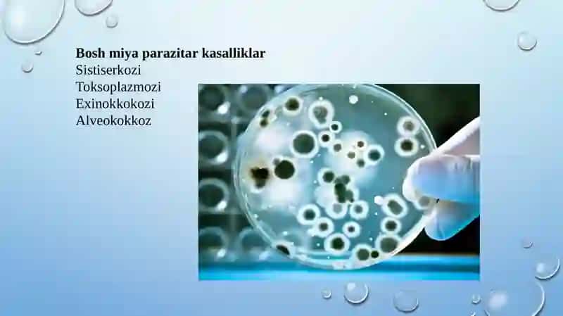 Boshmiyaning parazitar kasalliklari 3