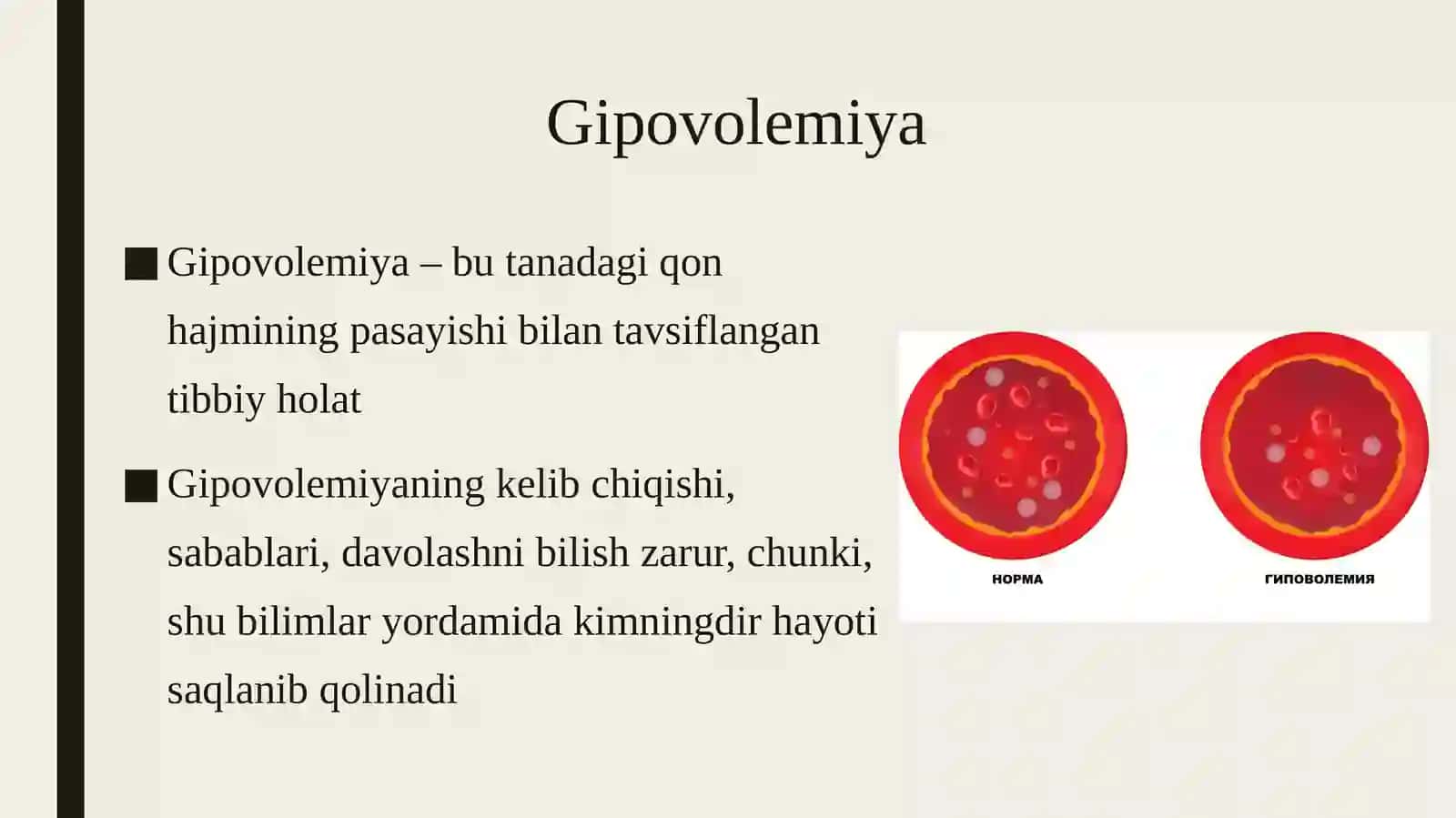 Gipovolemiyalar 3