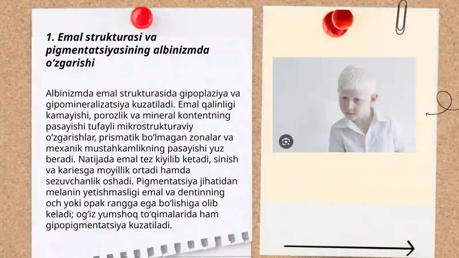 Albinizmda tish jagʻ tizimidagi oʻzgarishlar 3