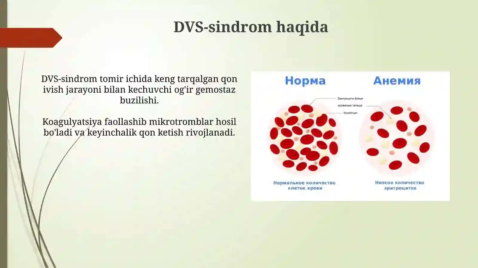 DVS - sindrom 3