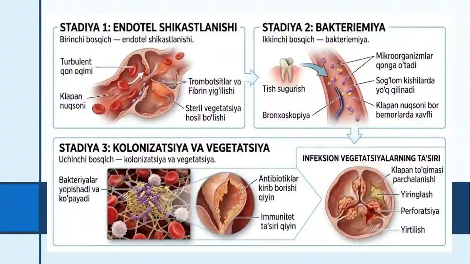 INFEKSION ENDOKARDIT PREZENTATSIYA 3