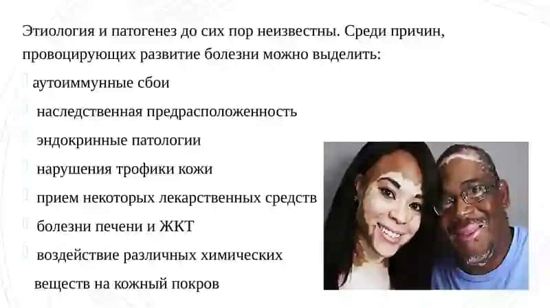 Витилиго 3