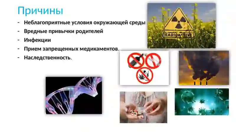 Аномалии развития селезенки – это стойкие изменения морфологической структуры органа, возникающие 3
