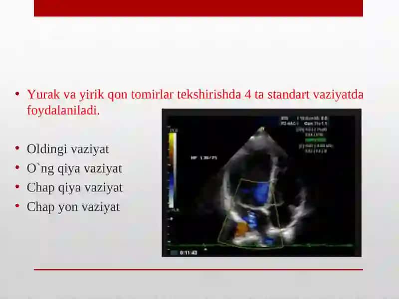 Yurak va yirik qon tomirlar kasalliklarining kompleks nur diagnostikasi 3