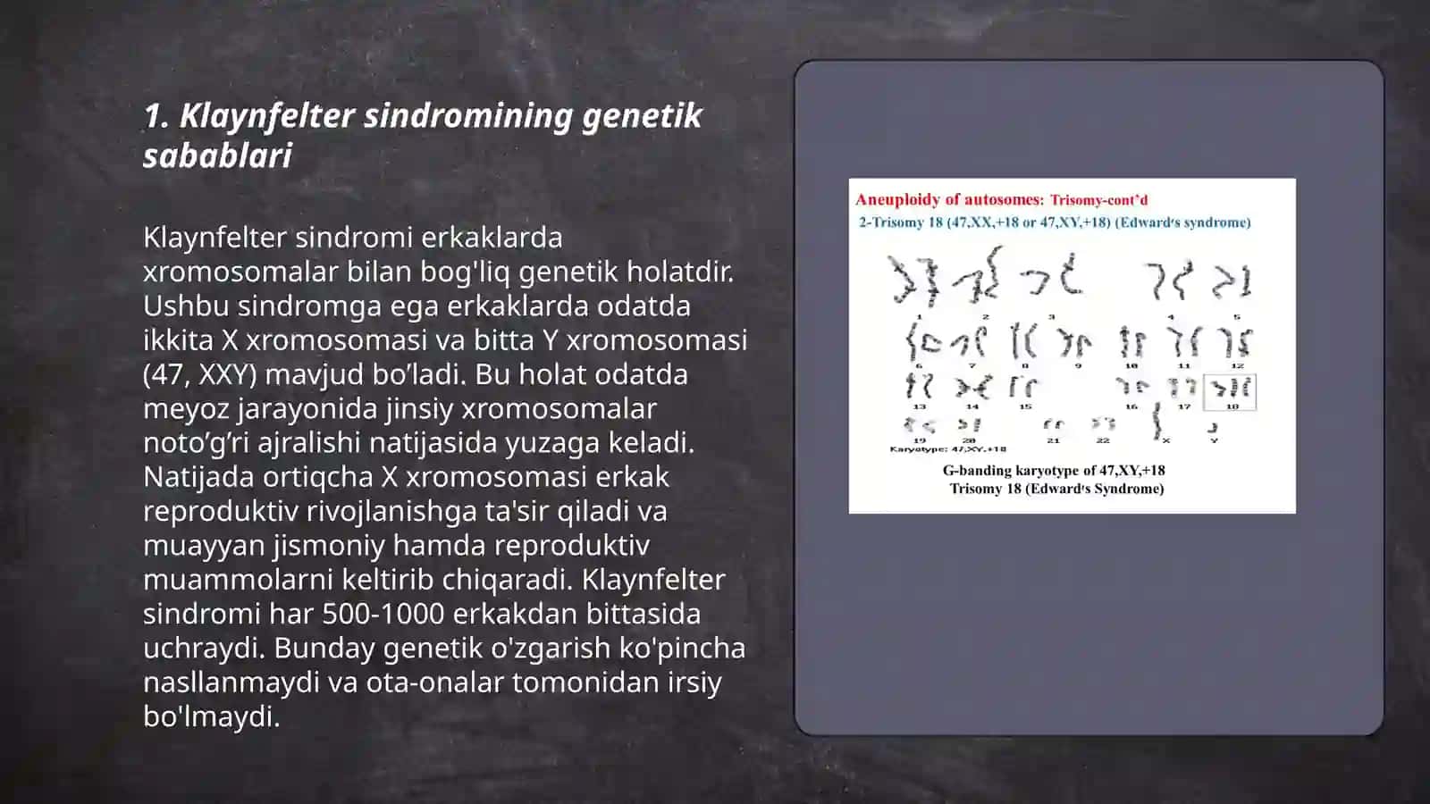 Klaynfelter Sindromi 3