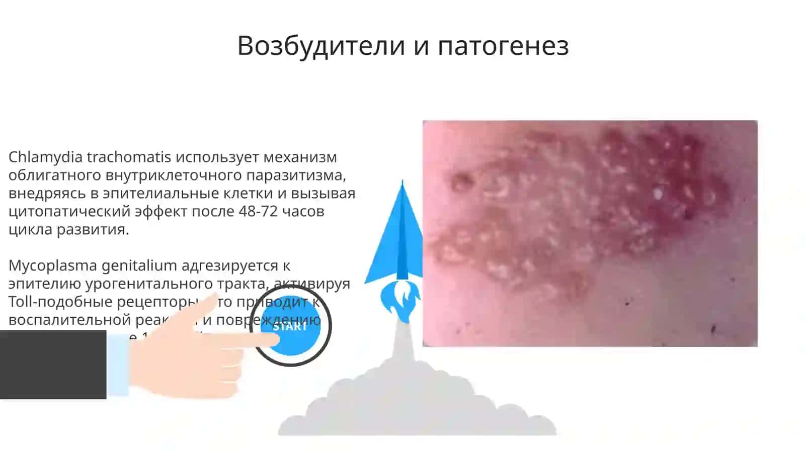 Хламидиоз, микоплазмоз, трихомониаз, мягкий шанкр: характеристика возбудителей и диагностика 3