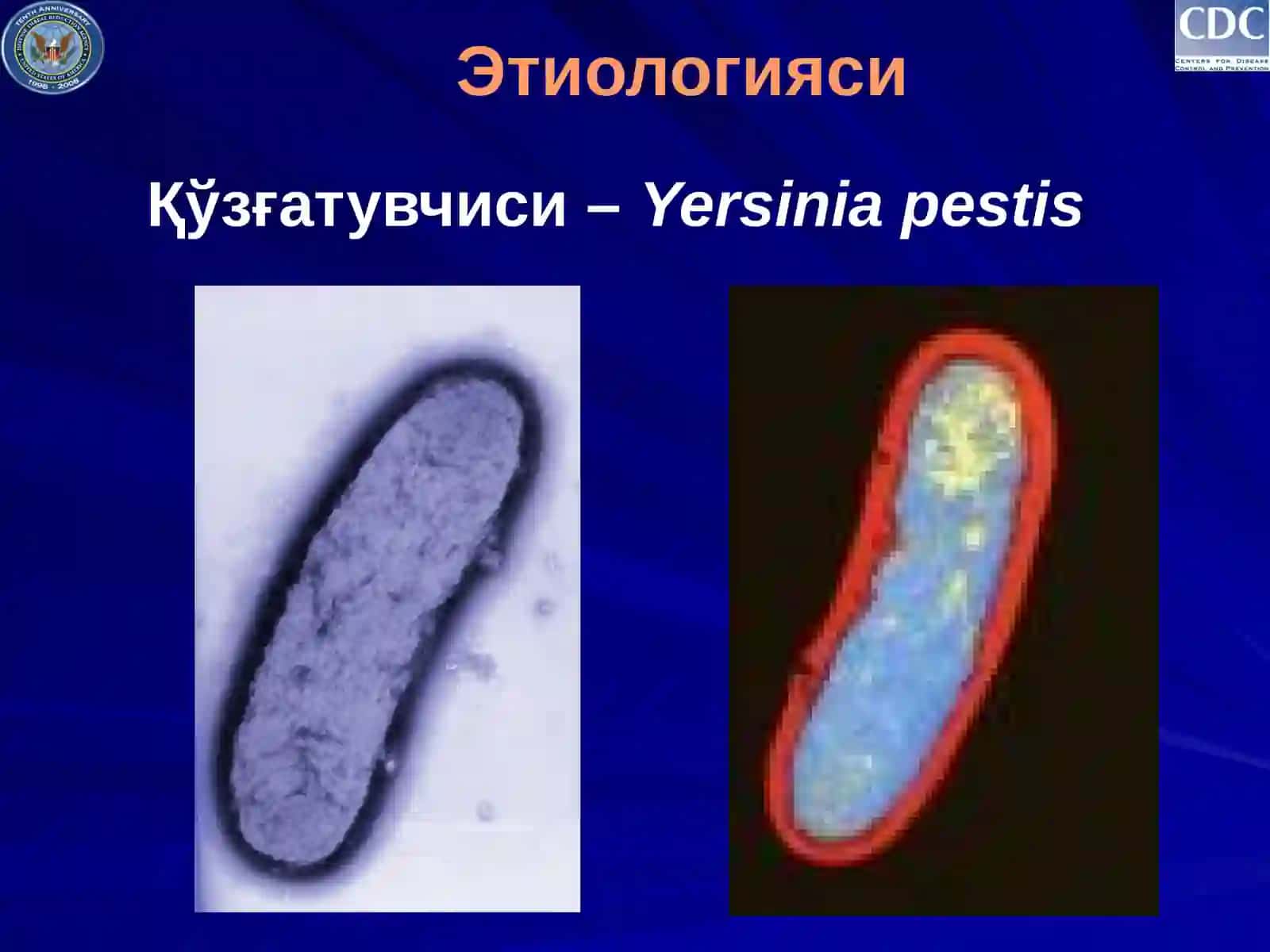 Ўлат(чума) - O'lat kasallgi 3