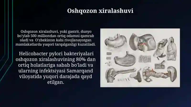 Oshqozon kasalliklari 3