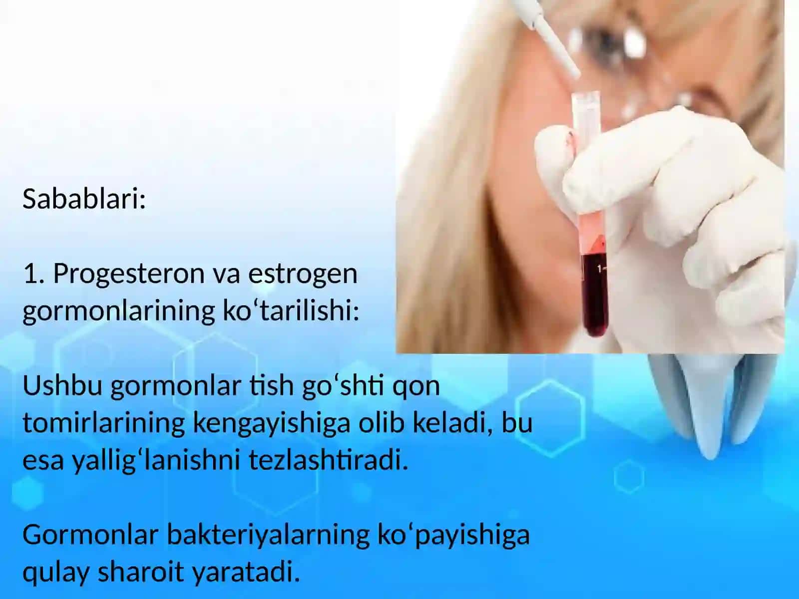 Homiladorlar gingiviti 3