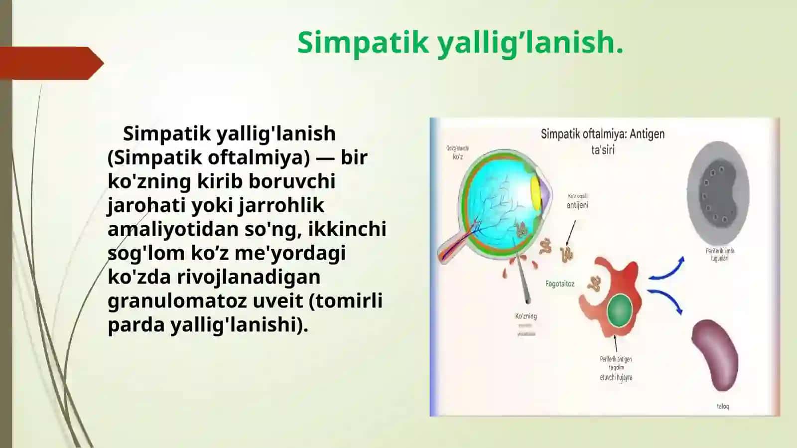 ko'z kasalliklari 3
