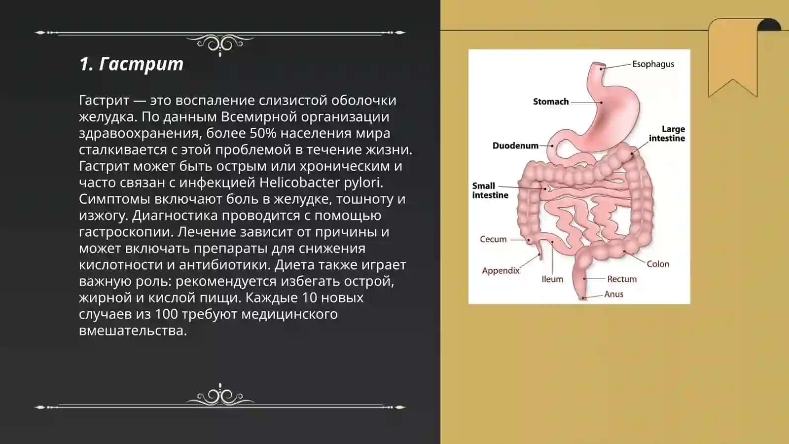 Гастрит 3