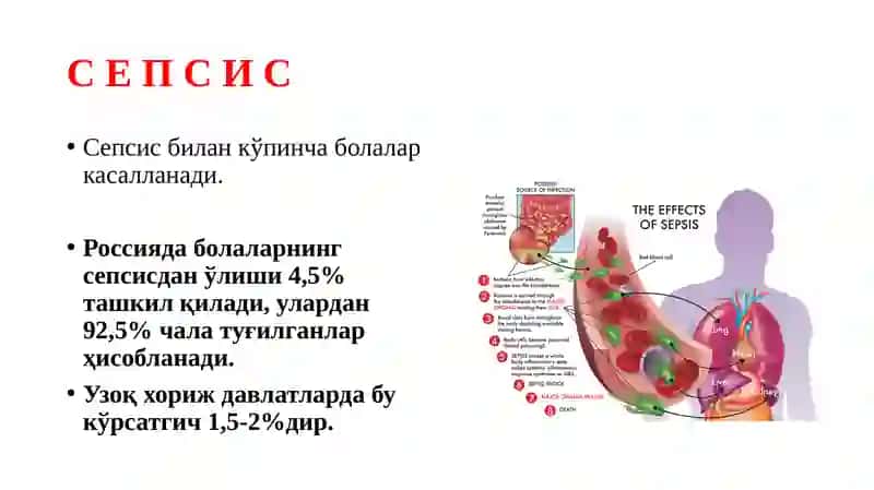 "Sepsis" mavzusi 3