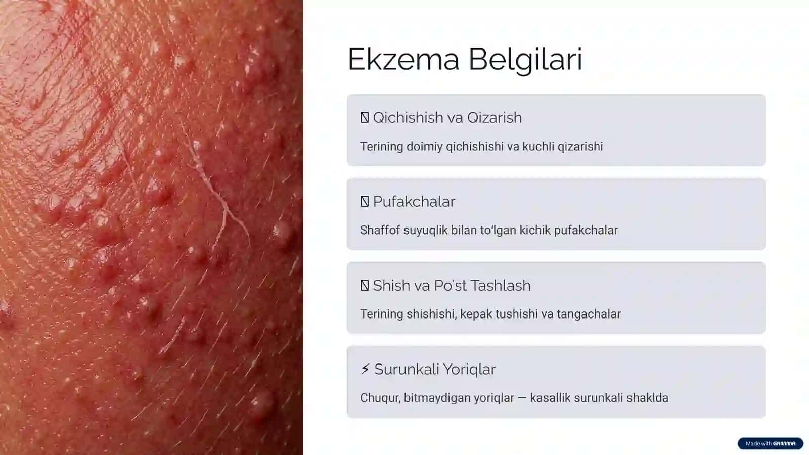 Ekzema va Uning Paydo Boʻlishi Sabablari 3