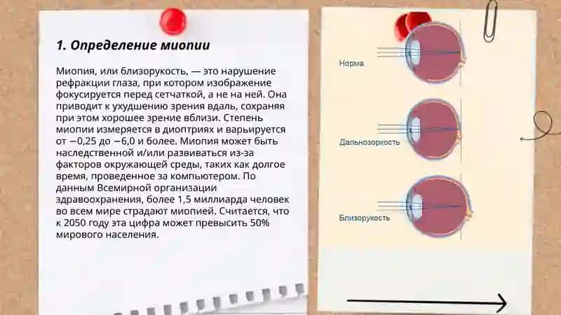 Миопия 3