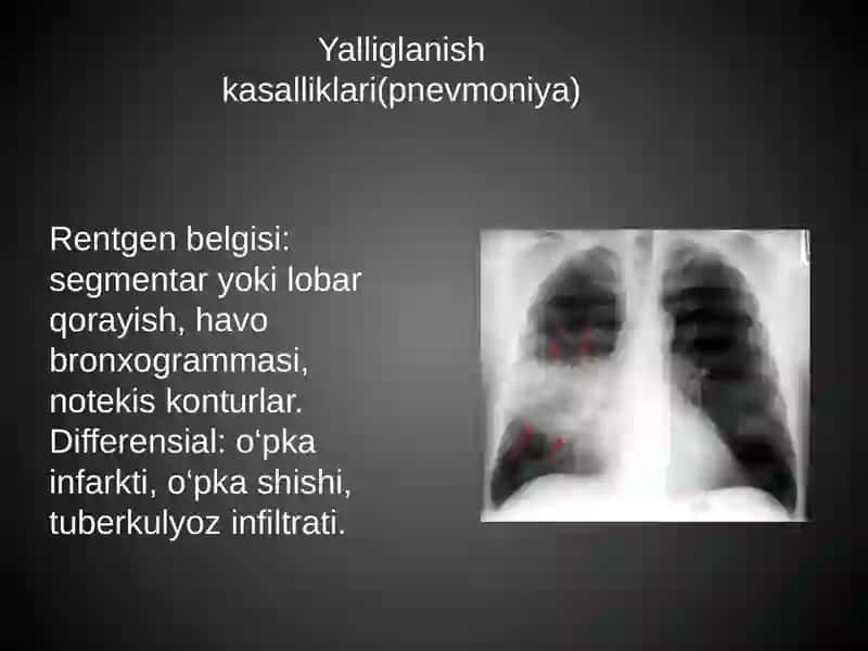 Rentgen bo‘yicha differensial diagnostika 3