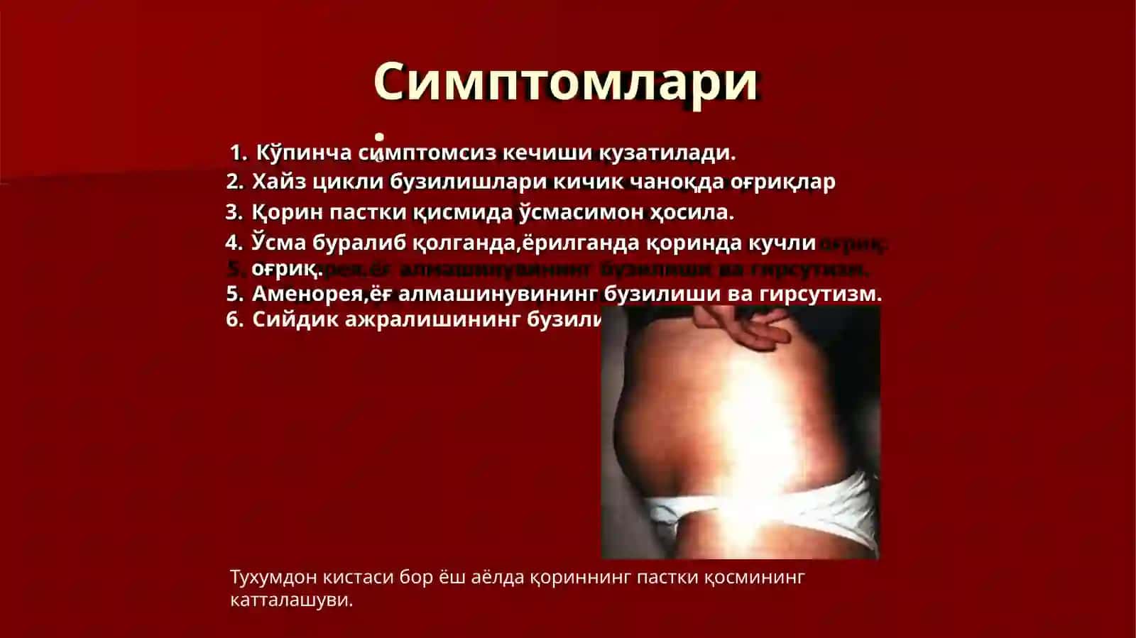 Тухумдон ўсмалари 3