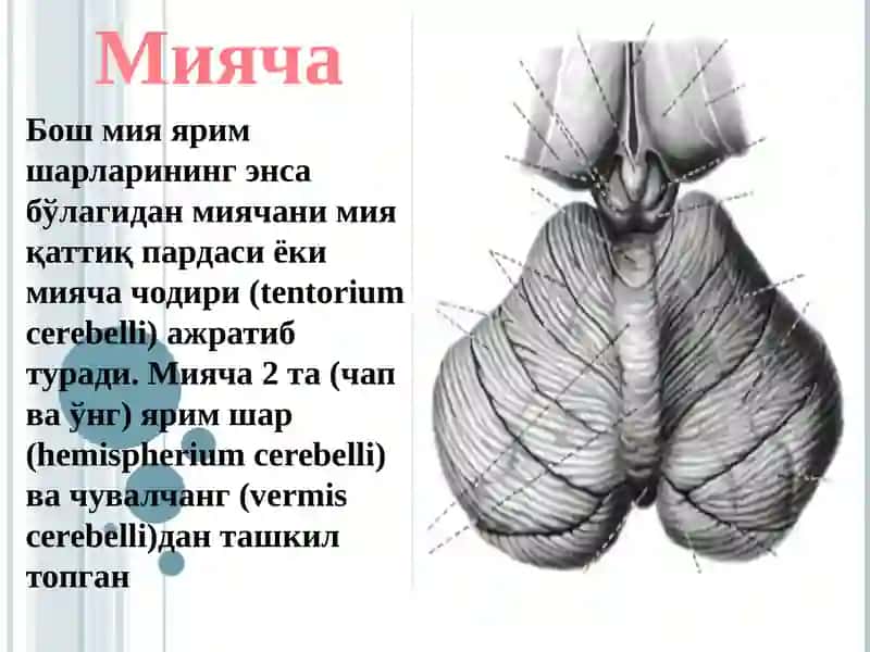Мияча 3