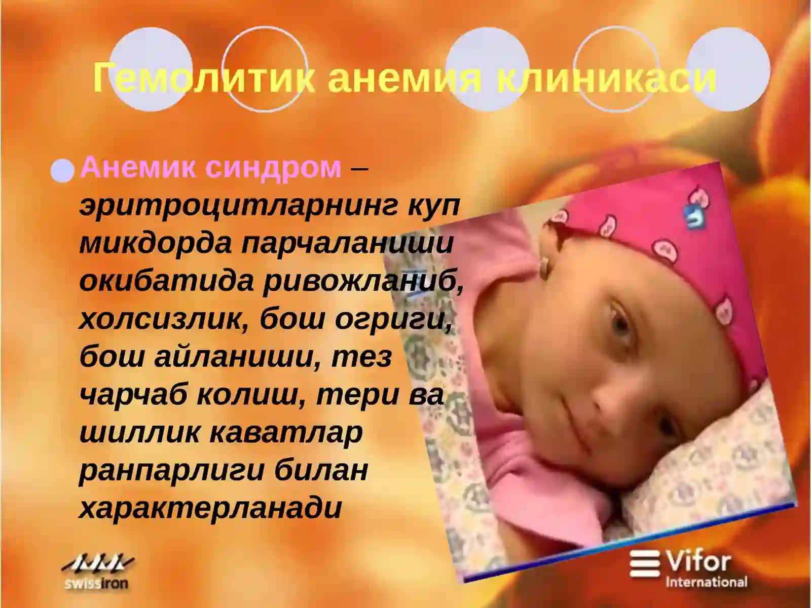 Гемолитик анемия 3